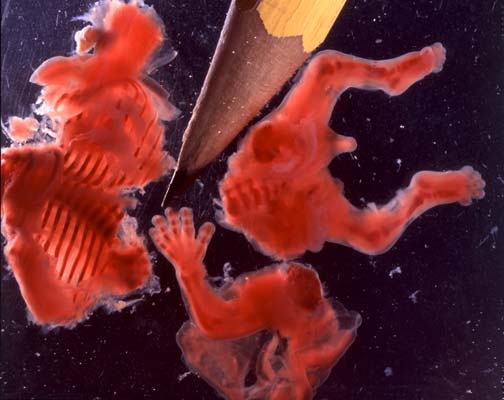 Аборт - убийство и тела, и сущности