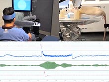 Телепатия спасет парализованных и людей, лишившихся конечностей